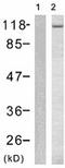 GRB2 Associated Binding Protein 1 antibody, TA321427, Origene, Western Blot image 