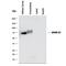 ADAM Metallopeptidase Domain 22 antibody, MAB49081, R&D Systems, Western Blot image 
