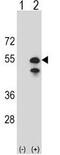 Carboxypeptidase N Subunit 1 antibody, GTX81518, GeneTex, Western Blot image 