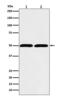 Tubulin antibody, M05613-6, Boster Biological Technology, Western Blot image 