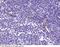 Acid Phosphatase 5, Tartrate Resistant antibody, 10550-T08, Sino Biological, Immunohistochemistry frozen image 