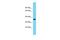 Uncharacterized protein C1orf222 antibody, PA5-71023, Invitrogen Antibodies, Western Blot image 