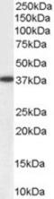 Aldo-Keto Reductase Family 1 Member A1 antibody, MBS421266, MyBioSource, Western Blot image 