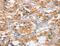 Aryl Hydrocarbon Receptor antibody, LS-C402975, Lifespan Biosciences, Immunohistochemistry paraffin image 