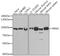 Ribonucleotide Reductase Catalytic Subunit M1 antibody, GTX66190, GeneTex, Western Blot image 