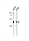 TATA-Box Binding Protein Associated Factor 7 antibody, 57-915, ProSci, Western Blot image 