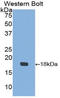 Insulin Like Growth Factor Binding Protein 3 antibody, LS-C301657, Lifespan Biosciences, Western Blot image 