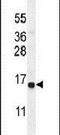 Cysteine Rich Hydrophobic Domain 2 antibody, PA5-23975, Invitrogen Antibodies, Western Blot image 