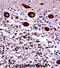 Neuronal Calcium Sensor 1 antibody, abx028150, Abbexa, Immunohistochemistry paraffin image 