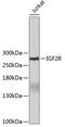 Insulin Like Growth Factor 2 Receptor antibody, 19-102, ProSci, Western Blot image 