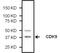 Cyclin Dependent Kinase 9 antibody, MA5-14912, Invitrogen Antibodies, Western Blot image 