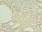 Heterogeneous Nuclear Ribonucleoprotein L antibody, LS-C369787, Lifespan Biosciences, Immunohistochemistry paraffin image 