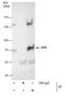 Spleen Associated Tyrosine Kinase antibody, PA5-27262, Invitrogen Antibodies, Immunoprecipitation image 