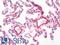 Melanoma Cell Adhesion Molecule antibody, LS-B10746, Lifespan Biosciences, Immunohistochemistry paraffin image 