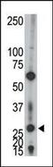 Adenylate Kinase 2 antibody, PA5-15430, Invitrogen Antibodies, Western Blot image 