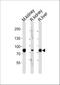 Enoyl-CoA Hydratase And 3-Hydroxyacyl CoA Dehydrogenase antibody, A05757-3, Boster Biological Technology, Western Blot image 