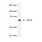 X-Ray Repair Cross Complementing 6 antibody, GTX77607, GeneTex, Western Blot image 