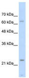 Troponin I1, Slow Skeletal Type antibody, TA346351, Origene, Western Blot image 