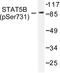 Signal Transducer And Activator Of Transcription 5A antibody, LS-C192195, Lifespan Biosciences, Western Blot image 