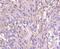 Heat Shock Transcription Factor 1 antibody, NBP2-67455, Novus Biologicals, Immunohistochemistry paraffin image 
