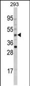 Arylacetamide Deacetylase antibody, PA5-72471, Invitrogen Antibodies, Western Blot image 