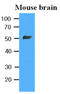 Tubulin antibody, LS-B6267, Lifespan Biosciences, Western Blot image 