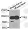 Transferrin Receptor 2 antibody, A9845, ABclonal Technology, Western Blot image 