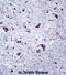 Casein Kinase 1 Gamma 1 antibody, abx027823, Abbexa, Immunohistochemistry frozen image 