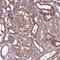 Cytosolic Iron-Sulfur Assembly Component 3 antibody, PA5-59325, Invitrogen Antibodies, Immunohistochemistry paraffin image 