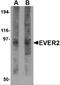 Transmembrane Channel Like 8 antibody, 4657, ProSci, Western Blot image 