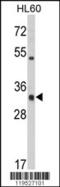 Major Histocompatibility Complex, Class II, DR Alpha antibody, 62-474, ProSci, Western Blot image 