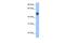 3-Oxoacid CoA-Transferase 1 antibody, PA5-43183, Invitrogen Antibodies, Western Blot image 