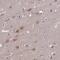 Tubulin Folding Cofactor B antibody, HPA041428, Atlas Antibodies, Immunohistochemistry paraffin image 