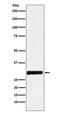 Annexin A4 antibody, M04840-1, Boster Biological Technology, Western Blot image 