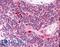 Autoimmune Regulator antibody, LS-B1740, Lifespan Biosciences, Immunohistochemistry frozen image 