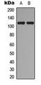 DNA Topoisomerase III Alpha antibody, MBS8213918, MyBioSource, Western Blot image 