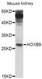Homeobox B9 antibody, abx125959, Abbexa, Western Blot image 