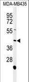 NADPH Oxidase Activator 1 antibody, LS-C162950, Lifespan Biosciences, Western Blot image 