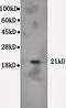 Transient Receptor Potential Cation Channel Subfamily V Member 5 antibody, orb389652, Biorbyt, Western Blot image 