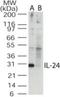 Interleukin-24 antibody, NB100-56407, Novus Biologicals, Western Blot image 