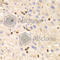 Lymphocyte Specific Protein 1 antibody, A5617, ABclonal Technology, Immunohistochemistry paraffin image 