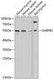 GA Binding Protein Transcription Factor Subunit Beta 2 antibody, GTX64862, GeneTex, Western Blot image 