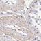 NME/NM23 Family Member 9 antibody, NBP2-48719, Novus Biologicals, Immunohistochemistry paraffin image 