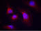 Spleen Associated Tyrosine Kinase antibody, LS-C203610, Lifespan Biosciences, Immunofluorescence image 