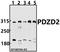 PDZ Domain Containing 2 antibody, A10309, Boster Biological Technology, Western Blot image 