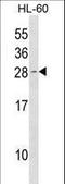 Cyclin Dependent Kinase Inhibitor 1B antibody, LS-C158186, Lifespan Biosciences, Western Blot image 