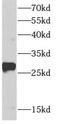 Armadillo Repeat Containing 7 antibody, FNab00586, FineTest, Western Blot image 