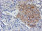 Regulatory Factor X Associated Ankyrin Containing Protein antibody, LS-C173734, Lifespan Biosciences, Immunohistochemistry paraffin image 
