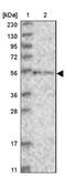 Zinc Finger Protein 76 antibody, NBP1-85323, Novus Biologicals, Western Blot image 