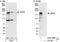 RAD54 Like 2 antibody, A302-066A, Bethyl Labs, Immunoprecipitation image 